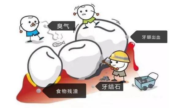 洗牙牙齿问题,医院口腔科洗牙和外面洗牙区别