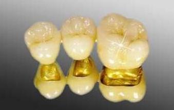 做烤瓷牙的利弊与危害,烤瓷牙失败的原因及解决方法