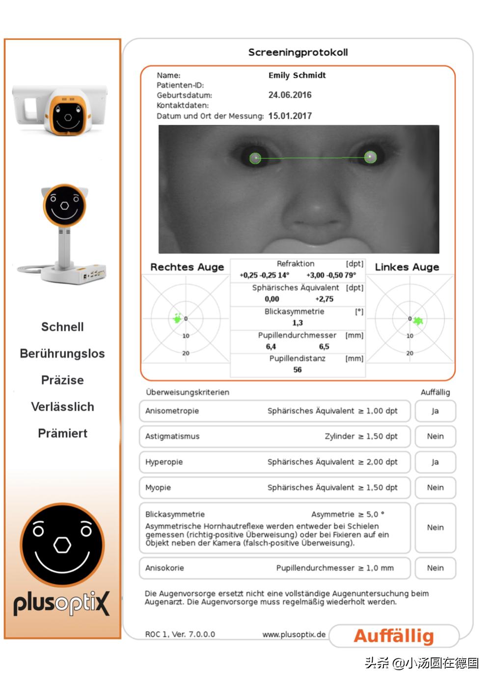 弱视检查,6月龄宝宝就可做,千万别忽视3岁前干预的关键期