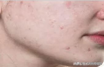 底妆氧化脱妆太快用什么粉底液,为什么底妆很不均匀