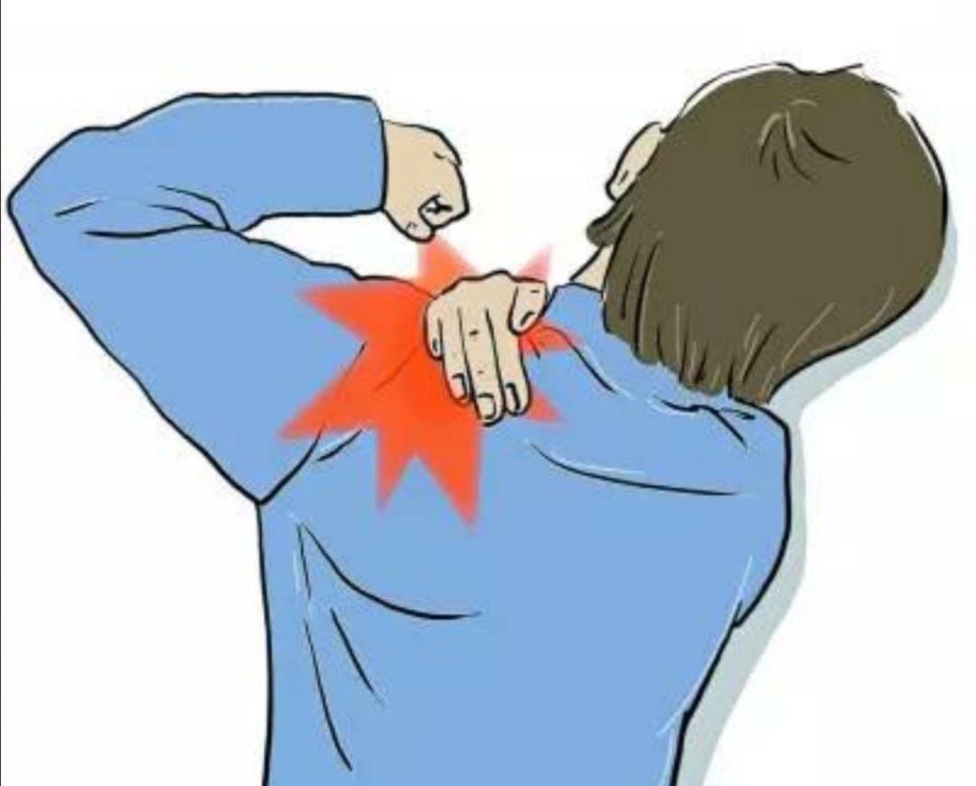 肩峰下撞击会引起什么症状,肩峰撞击导致手臂抬起来疼