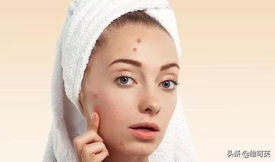 痘痘消炎产品推荐,护理祛痘流程