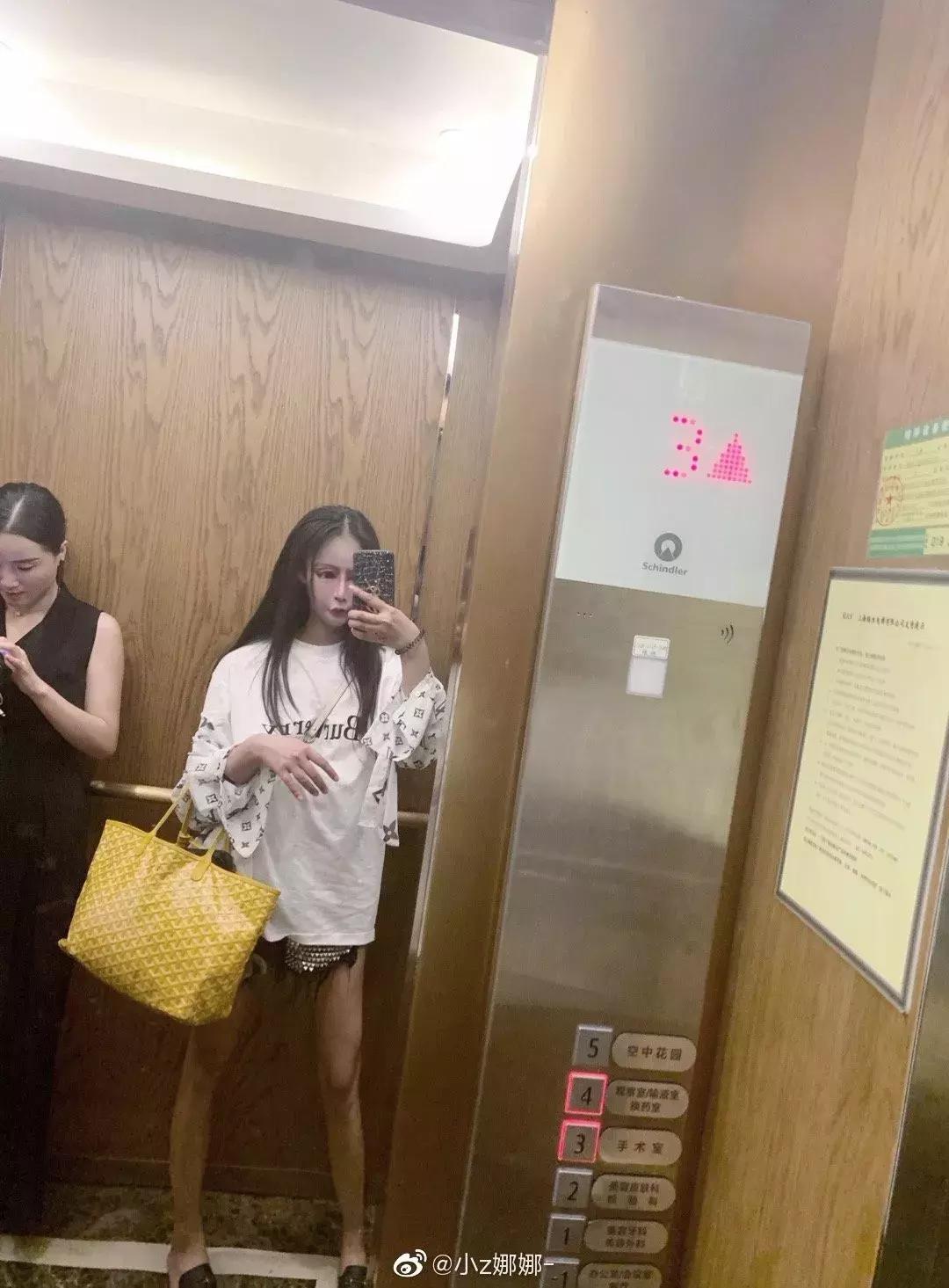 13岁开始整容，视李蒽熙为偶像！小Z娜娜是疯了吗？