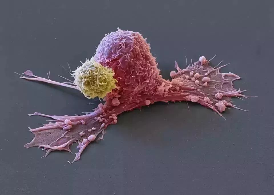 她拥有永生，靠此造福10亿人，死于癌症后，她的细胞带她重生！