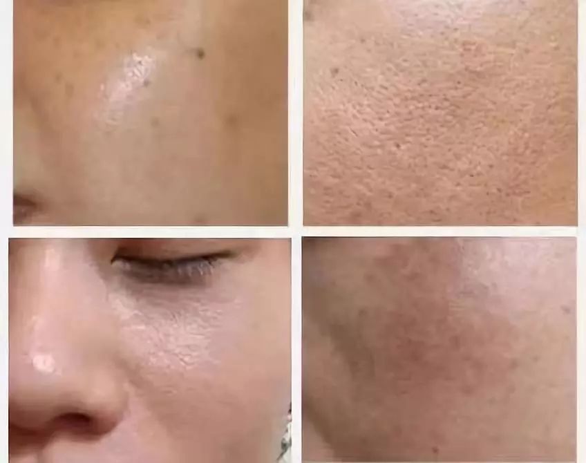 熬最深的夜,也要发最亮的光!烟酰胺精华,让你熬夜也有少女颜