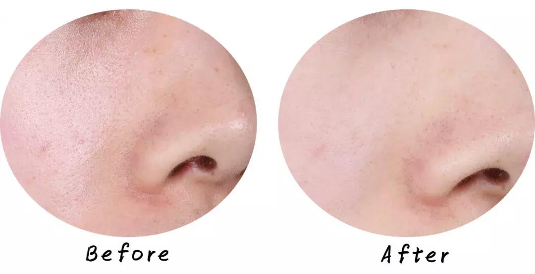 swisse麦卢卡蜂蜜排毒清洁面膜,超温和清洁面膜推荐哪个