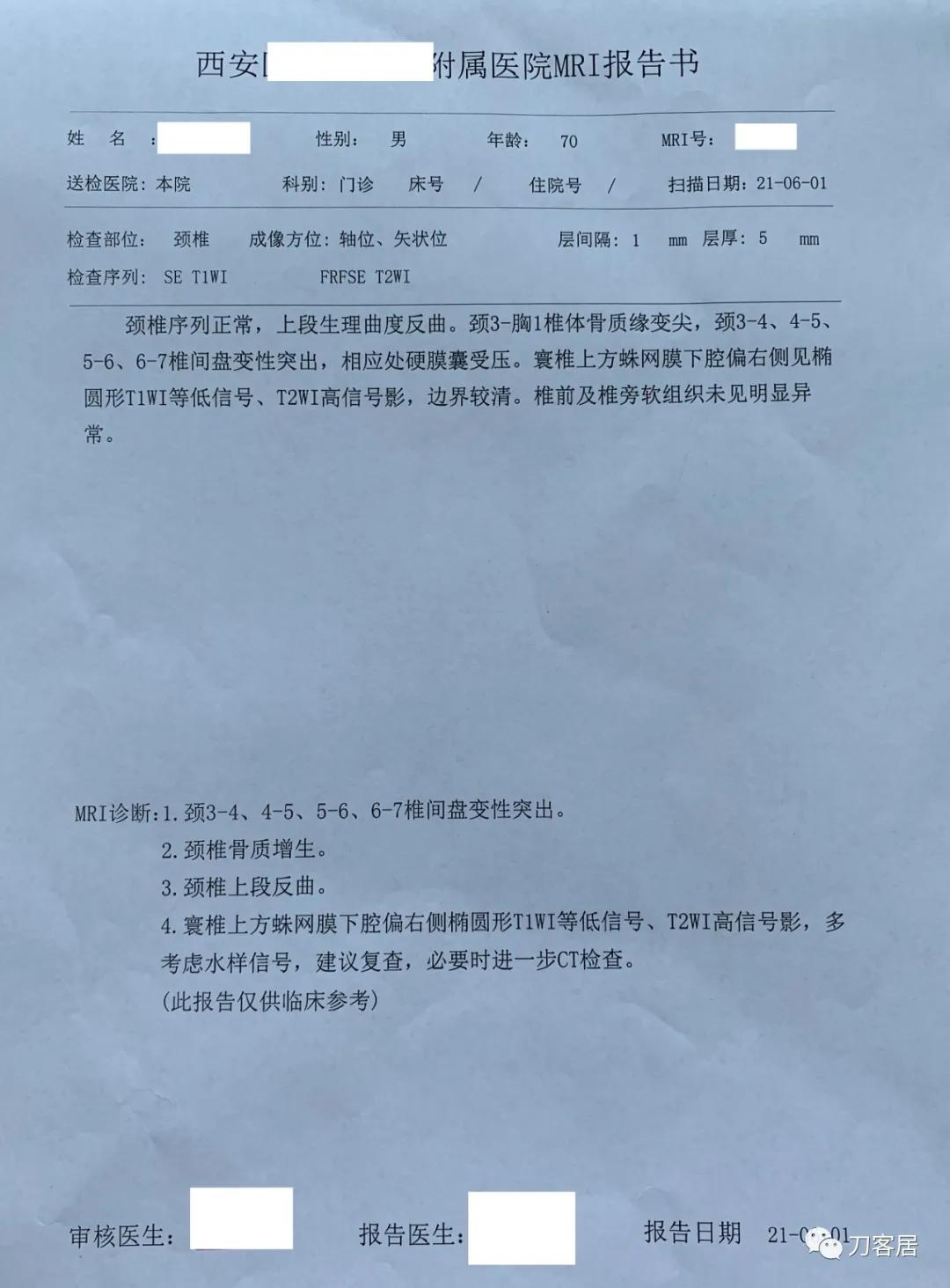 70岁男性，神经根型颈椎病，片子显示较严重，我依然先行保守治疗