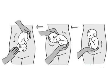 难产按肚子伸手转胎位,怀孕按压肚子导致流产