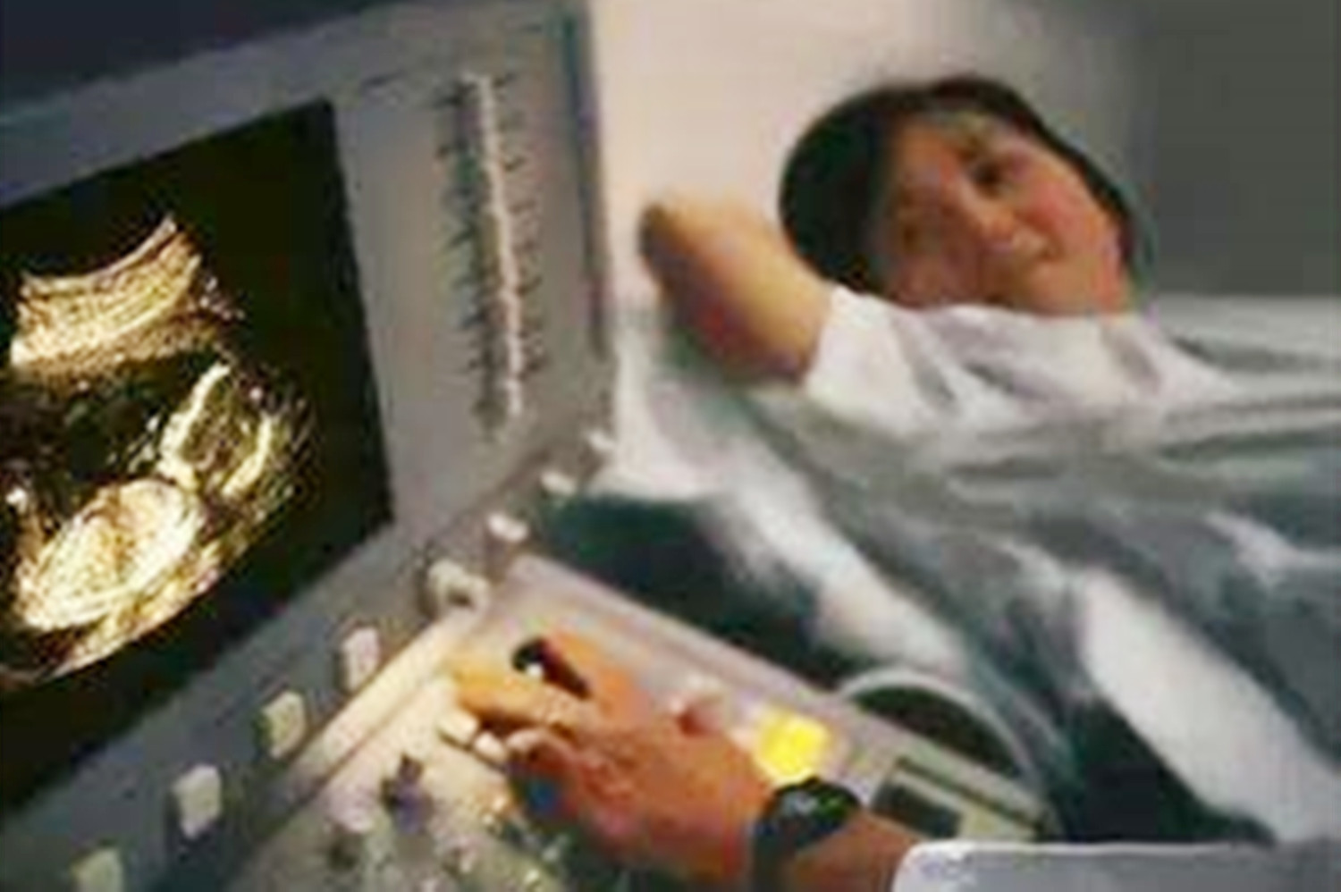 大排畸爬楼梯瞬间心率165,做大排畸为什么要爬楼梯