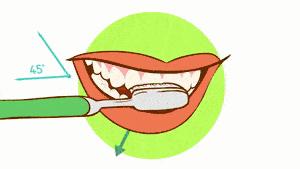 损伤了牙釉质该怎么修复,关于牙釉质损伤怎么修复