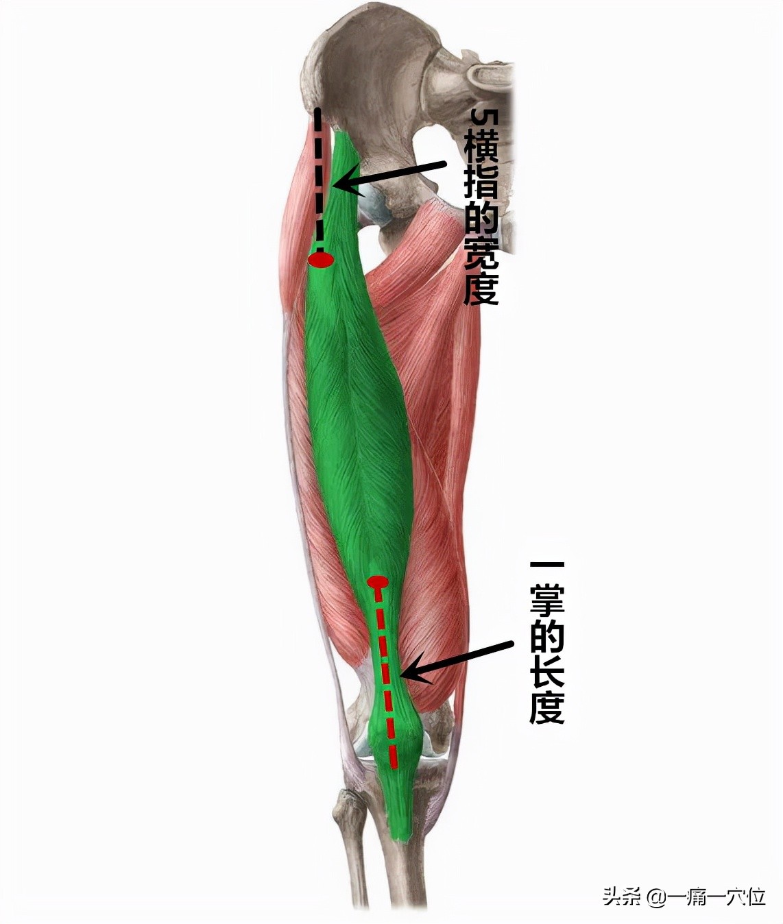 膝关节疼蹲不下针灸哪个穴,膝关节疼痛伸不开针灸治疗视频