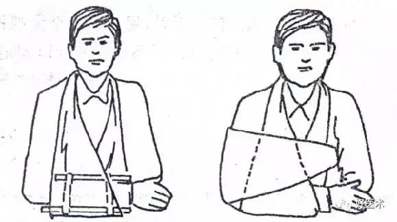 骨科急救处理流程图,骨科急救原则及注意事项