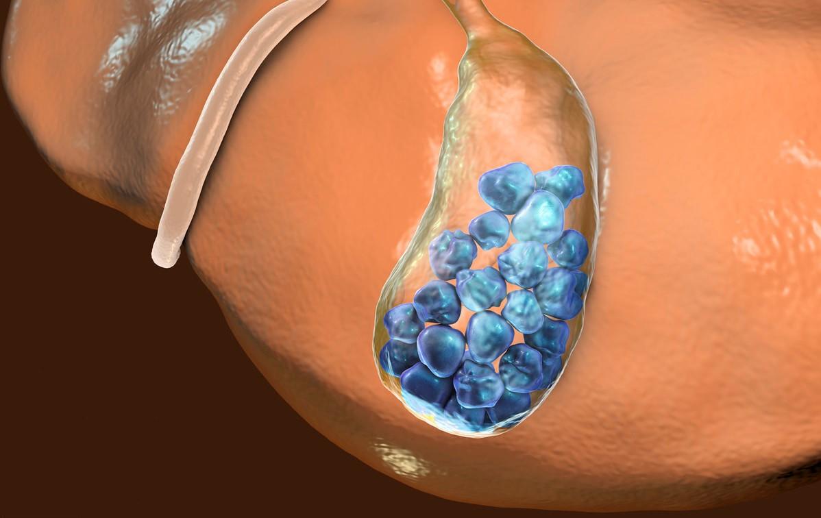 不吃早饭的危害和后果,长期不吃早饭的危害有哪些