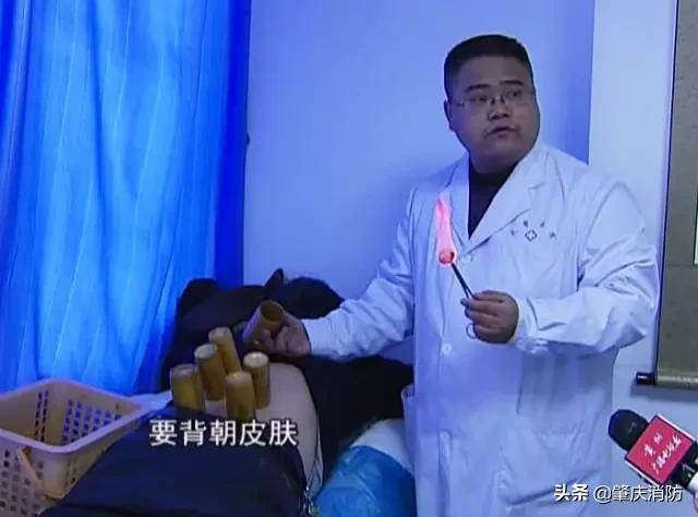 女子拔火罐被烧伤后续,明星拔火罐烧伤事件