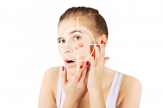 祛痘痘正确方法,怎么祛痘痘最快最有效方法