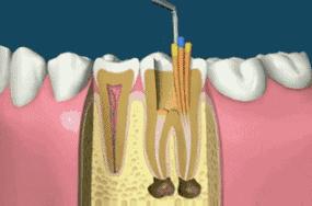 口腔治疗费用明细清单,昆明口腔治疗费用