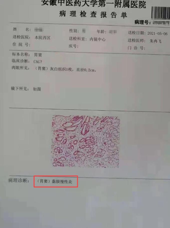 治疗重度肠上皮化生用什么药,30多岁得了肠化生还能治好吗