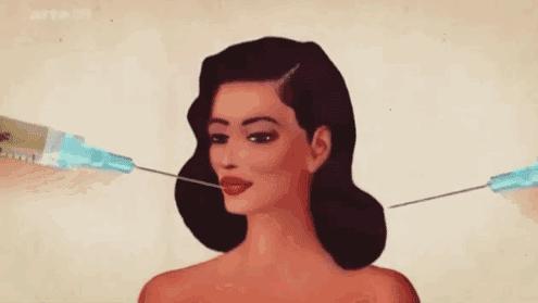 吸脂填充手术全过程,吸脂填充有多可怕