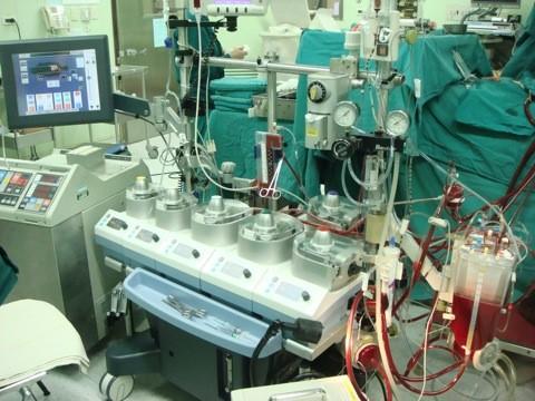 类风湿患者做血液过滤好吗,类风湿病人做透析治疗有用吗