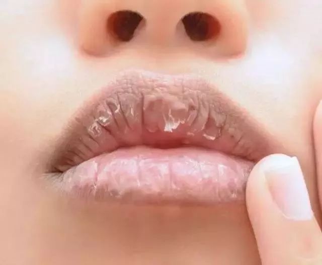 护唇没做好,再怎么好看的口红都没用