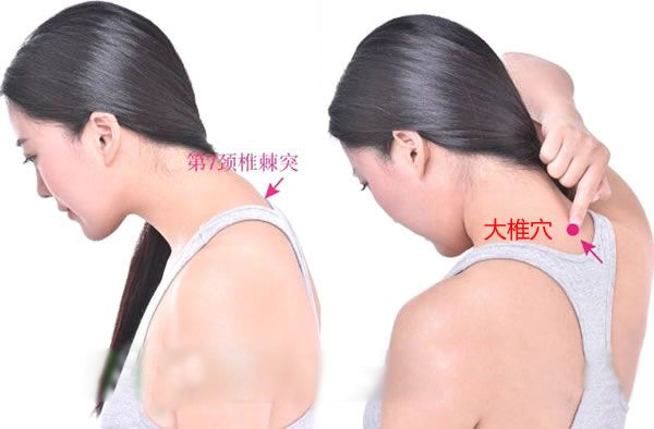 中医治湿疹的穴位,中医湿疹穴位