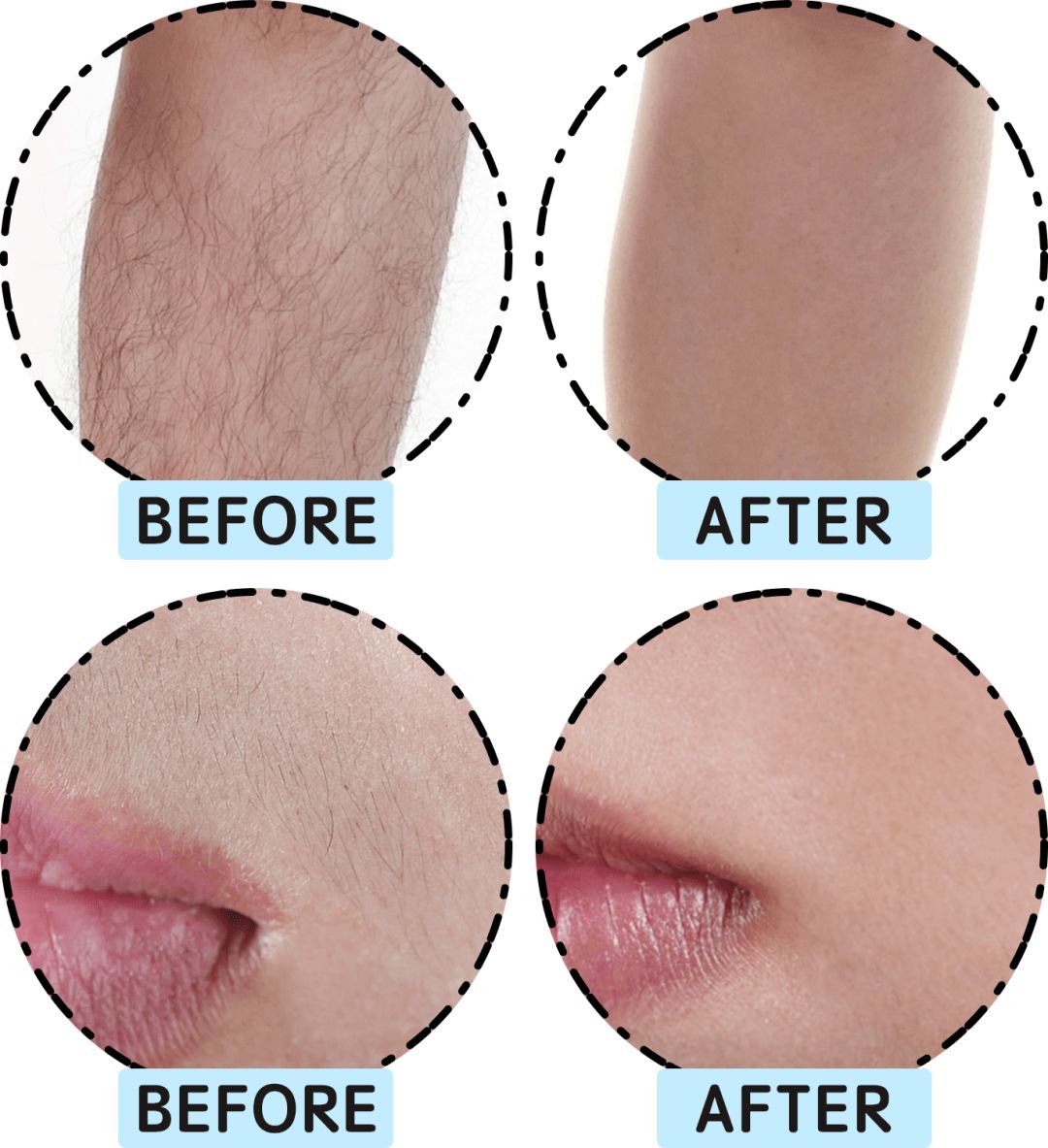 网红脱毛仪器家用评测,网红脱毛仪哪个好用又便宜