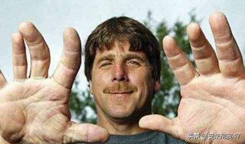 世界上最大的手掌和脚,世界手掌最大的人