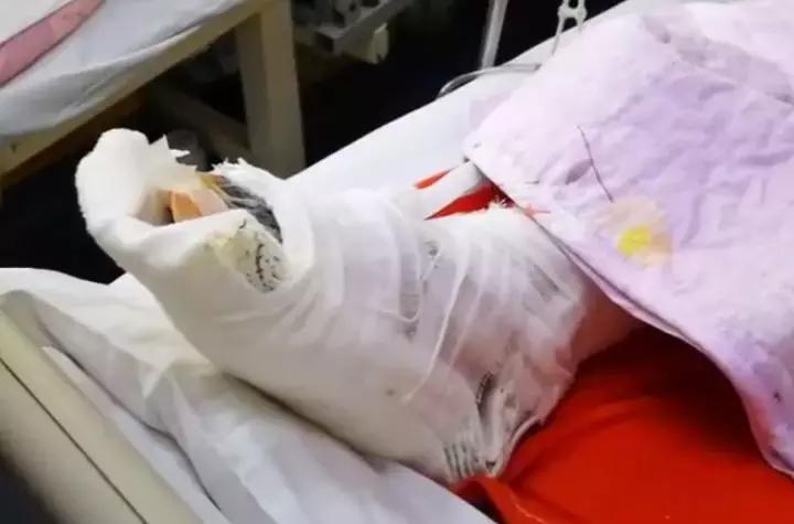 脚底起老茧是糖尿病引起的吗,糖尿病脚底老茧怎么治愈