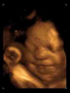 胎儿在肚子里发育的全过程照片,胎儿在肚子里的成长过程图片