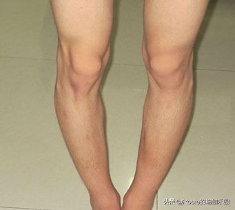 你以为你是翘臀其实是骨盆前倾,你以为的翘臀有可能是骨盆前倾