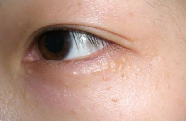 新手初学化妆教程怎么抹眼霜,眼霜的正确使用方法化妆师