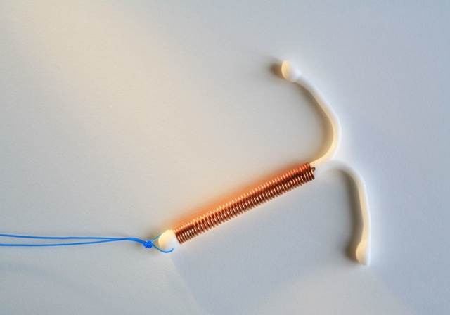 宝宝戴着节育器出生,命中注定的宝宝