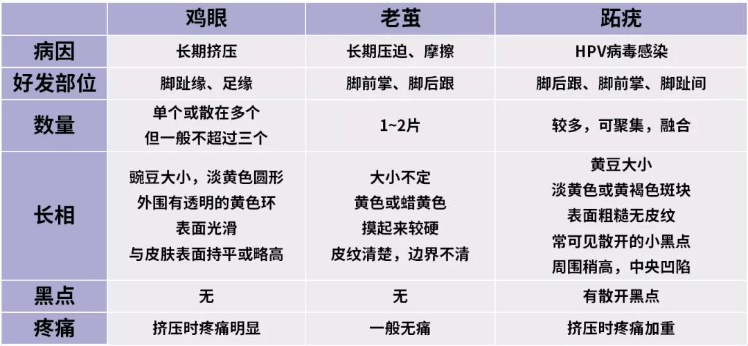 脚底长了鸡眼该怎么正确处理,脚底长鸡眼太深怎么挖出来