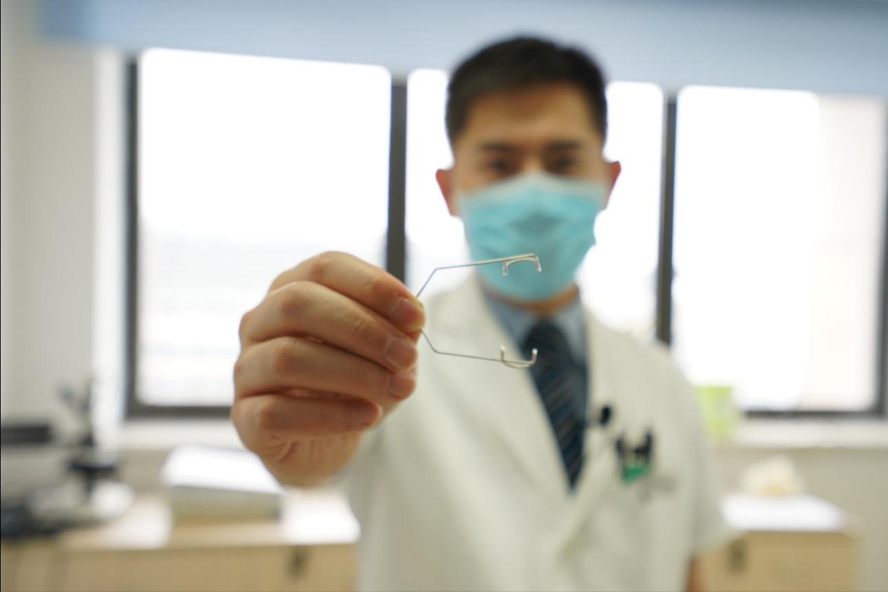 做近视手术是什么体验,近视手术体验