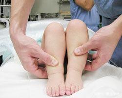 宝宝腿纹不对称是如何造成的,42天皮纹对称两个月后不对称