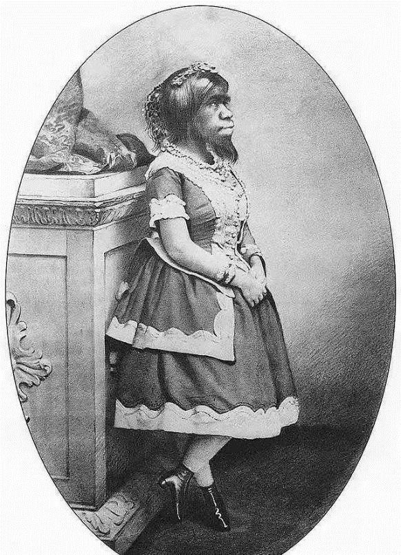 她身高1米38,拒绝20个求婚者,活着被当摇钱树,死后被做成标本