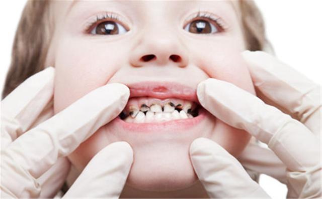 怎样预防乳牙未完全掉恒牙长出来,怎样预防乳牙未掉恒牙长出