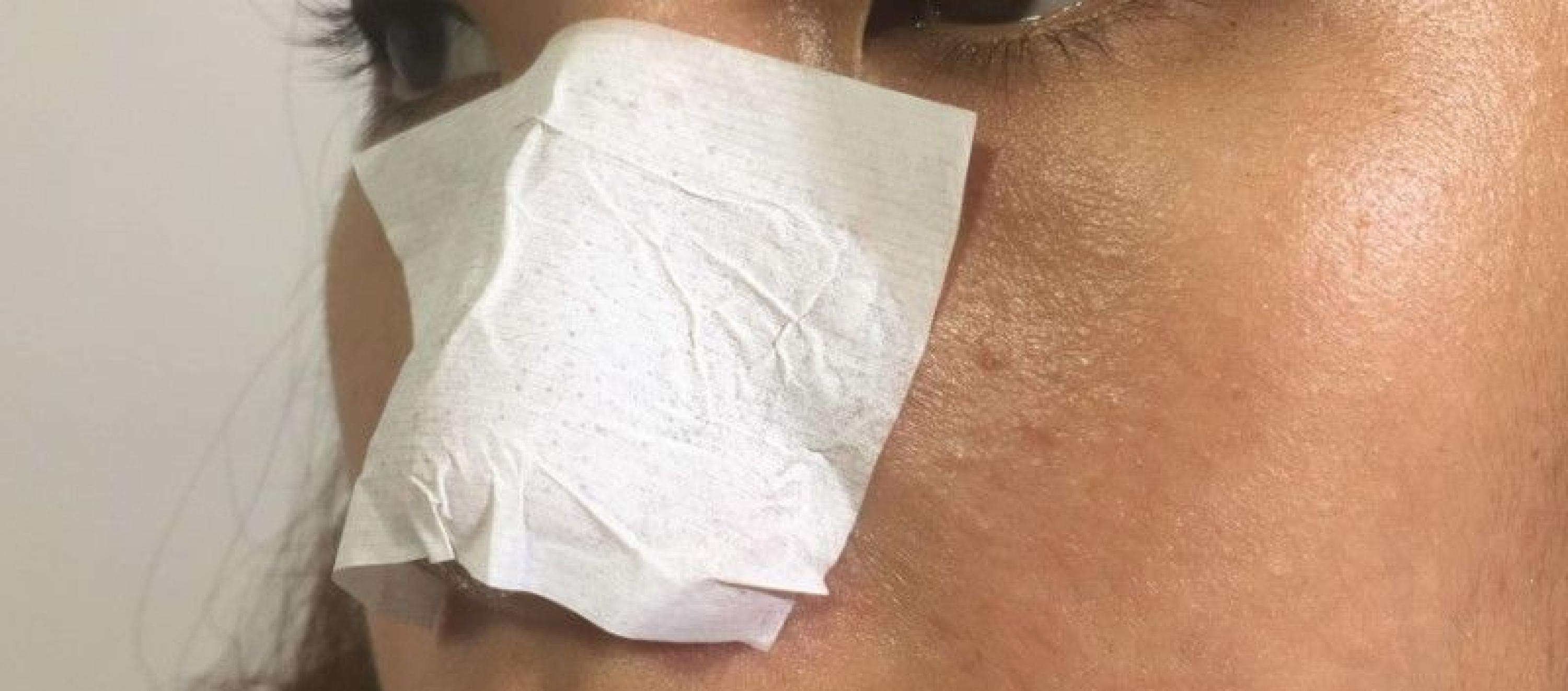 掏耳屎挤黑头粉刺清理毛孔有用吗,黑头粉刺到底要不要挤出来