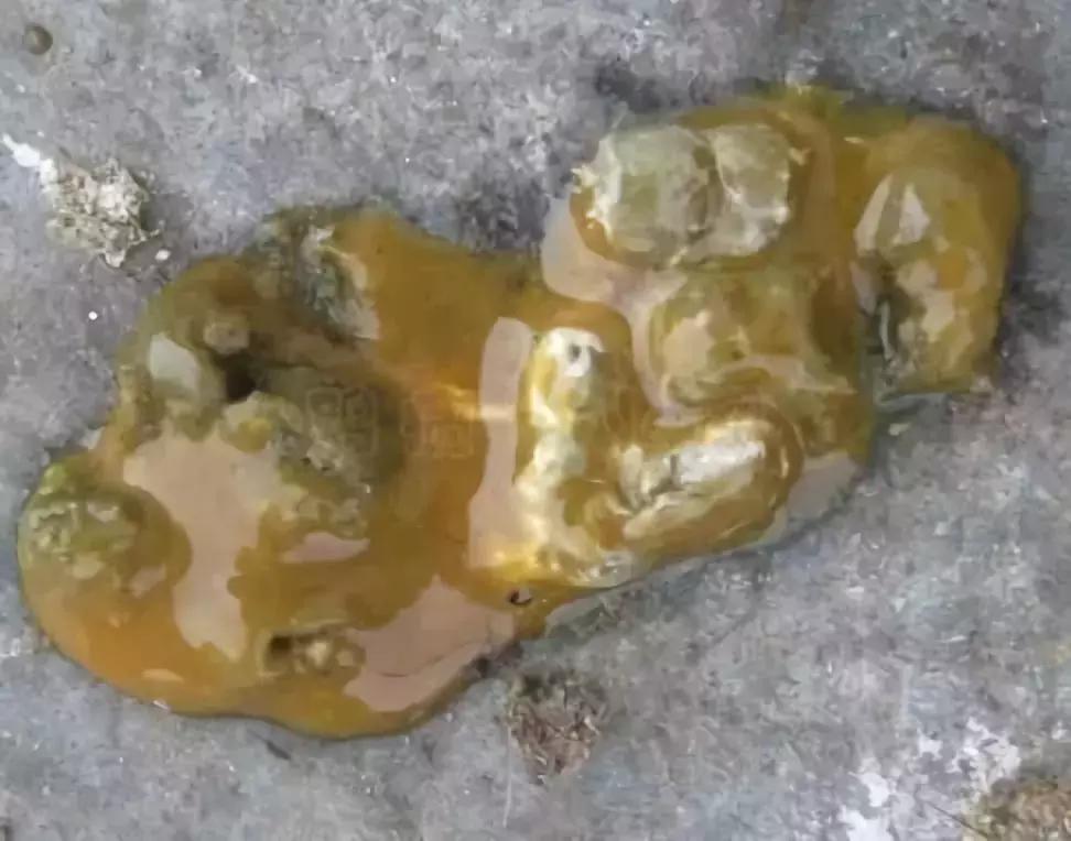 “五颜六色”的粪便背后隐藏着什么？又和肝脏疾病有怎样的联系呢