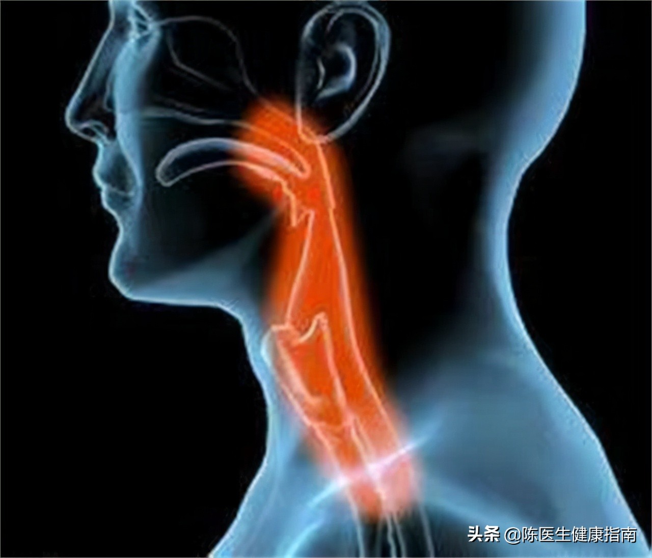 阿莫西林要认清只对这4种病有效,阿莫西林列入十种不能吃的药