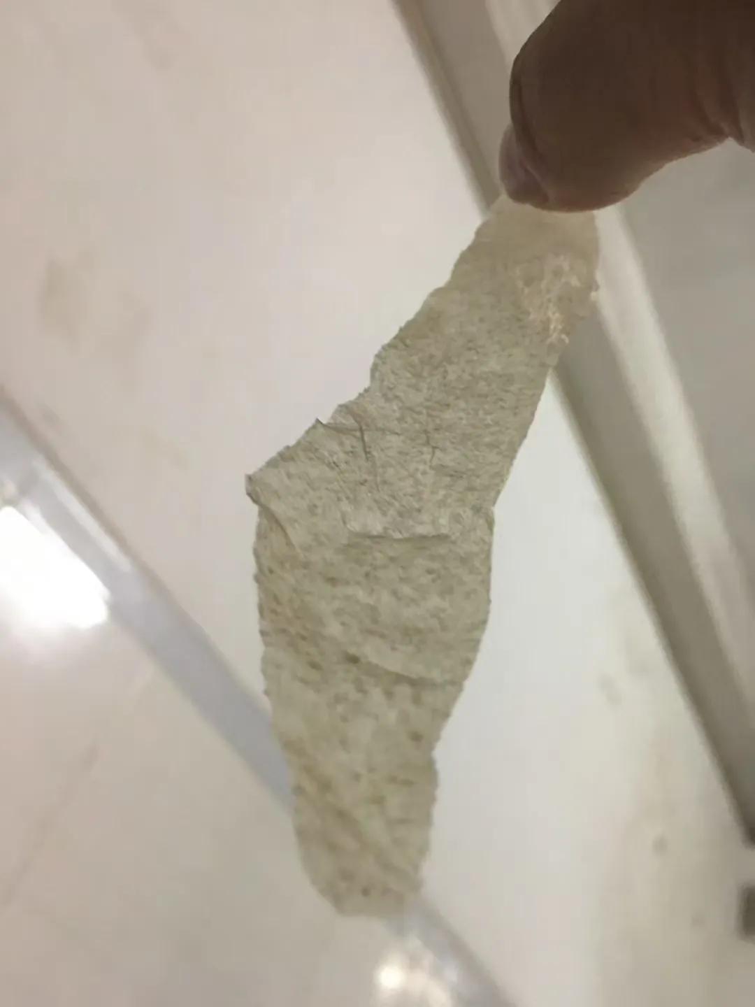 骨折人情冷暖,骨折后明白了人间冷暖