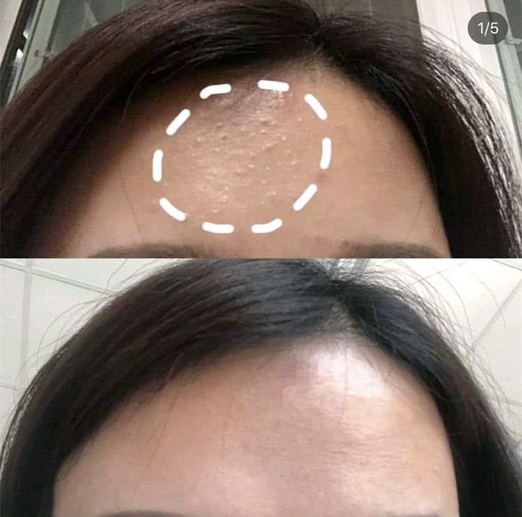 孙艺珍的颜值变化,孙艺珍颜值巅峰的笑容