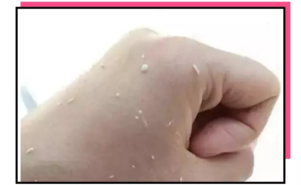 护肤品搓泥怎么救,护肤品搓泥怎么办