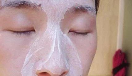 黑头粉刺护理误区分析图,美容院黑头粉刺闭口误区