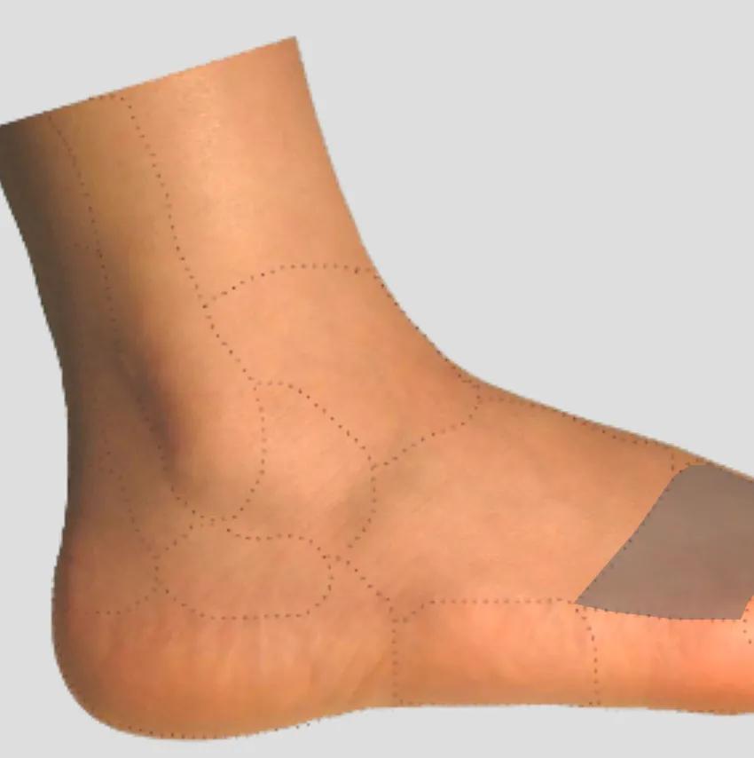 足踝各种疼痛的原因,足踝内侧疼痛自测