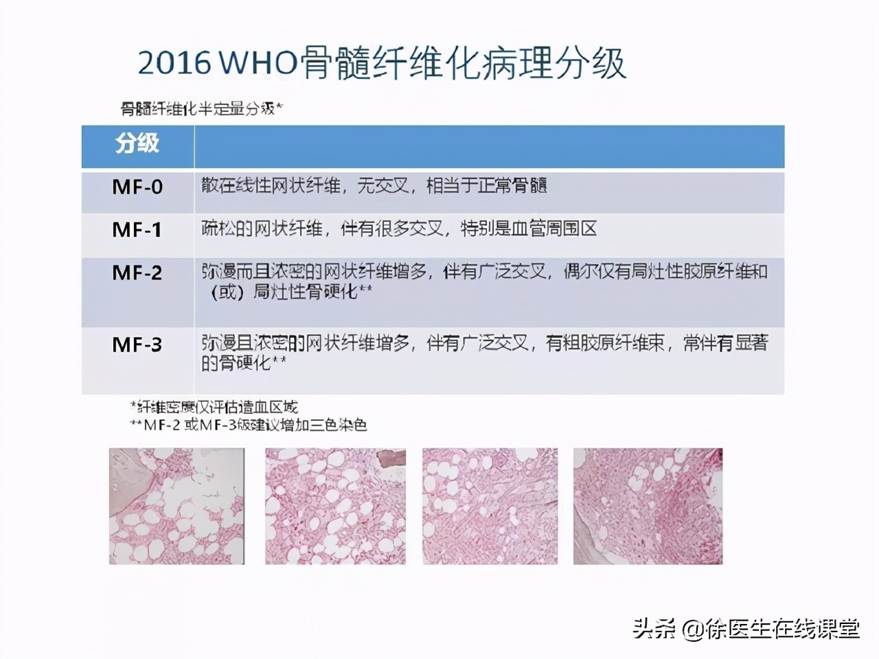 血常规能看出癌症转移吗,血常规能查出癌症骨转移吗