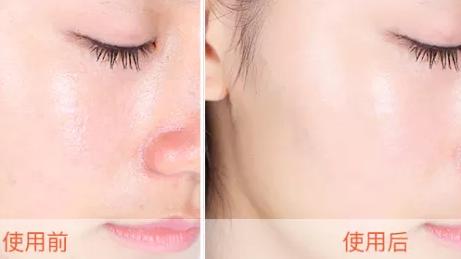 敏感肌换季好物,敏感肌水乳抗皱天花板