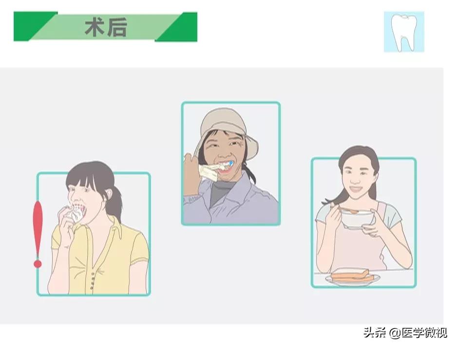 全瓷种植牙的牙基也是全瓷粉吗,种植牙全瓷和烤瓷有什么区别