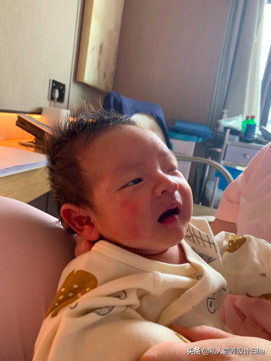 月子餐如何防止宝宝胀气腹泻,月子里宝妈出现湿疹忌口