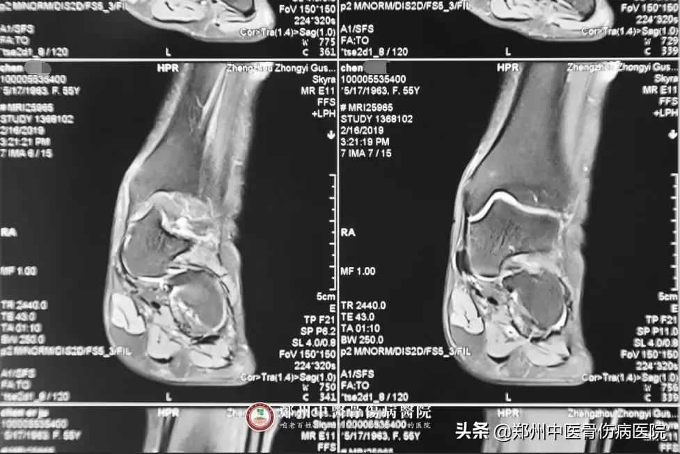 她辗转多家医院治疗未见好转，终在这里成功解除病痛！